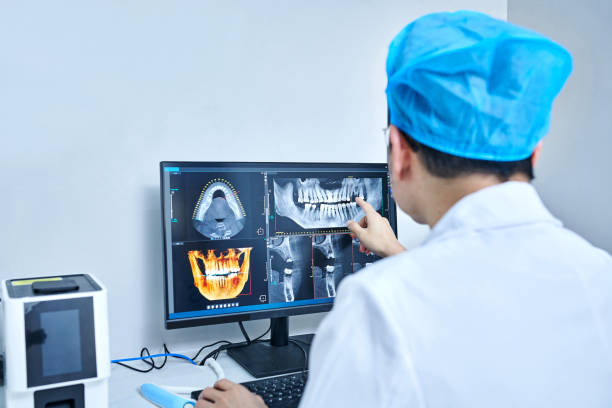 Best Emergency Wisdom Teeth Removal in Mandeville, LA