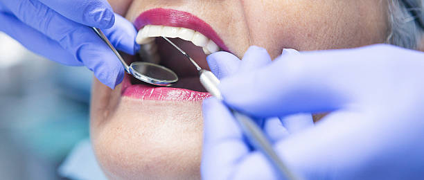 Best Emergency Tooth Extraction in Mandeville, LA